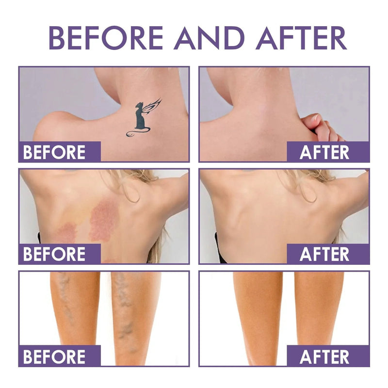 Body Coverage Perfector – Waterproof Leg & Body Makeup